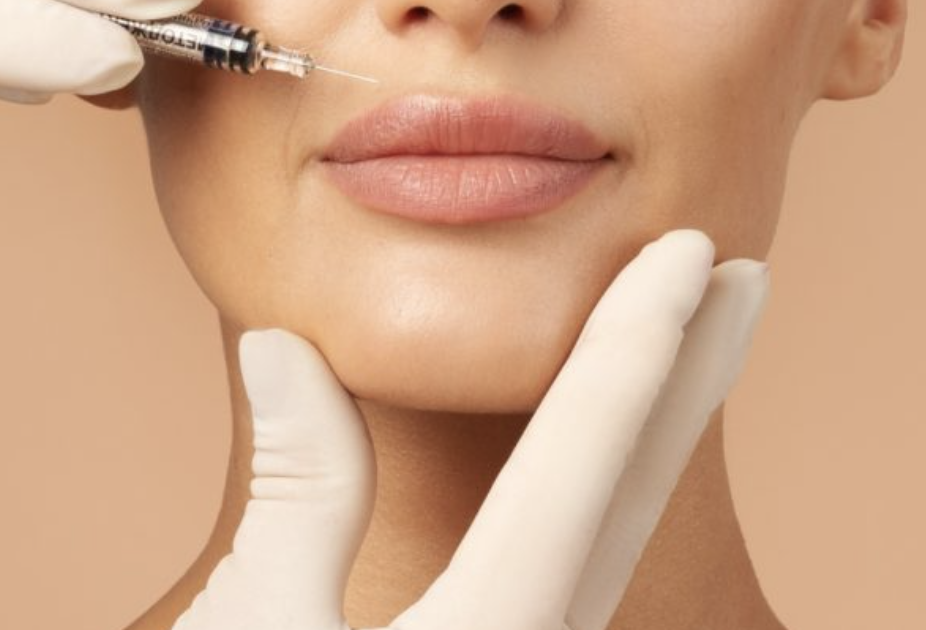 Dermal Filler